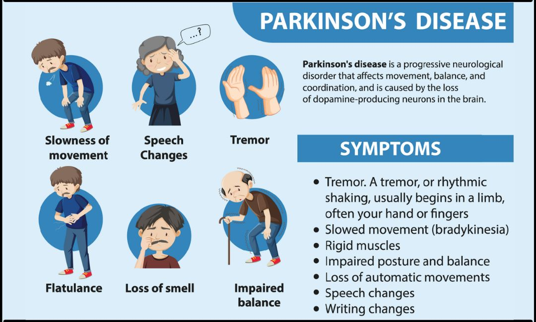 Parkinson’s Disease